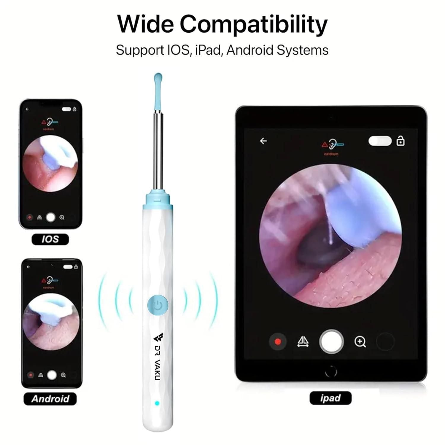 Smart Visual Ear Wax Cleaner – See. Clean. Care. ✨🦻
